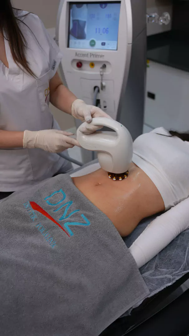 éclaircie régionale