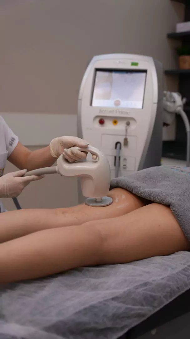 éclaircie régionale