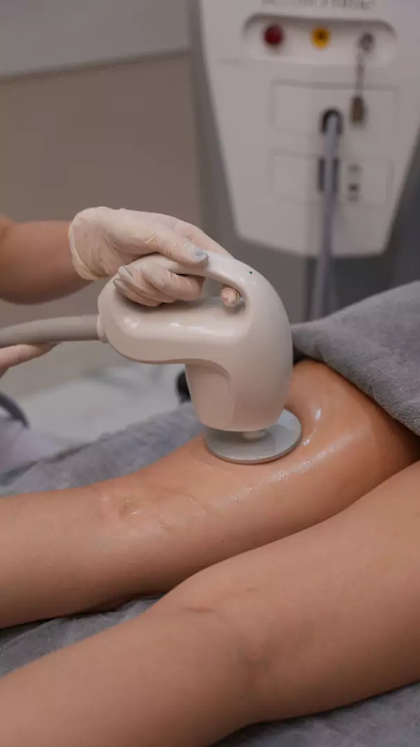 éclaircie régionale