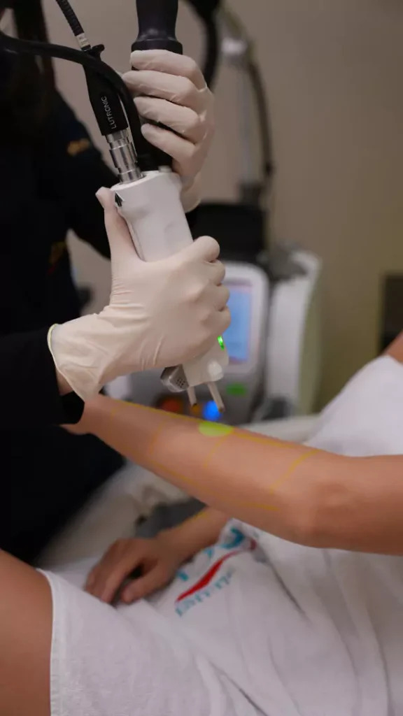 lazer epilasyon zararlı mı