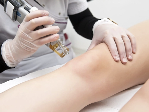 alexandrite-lazer-epilasyon