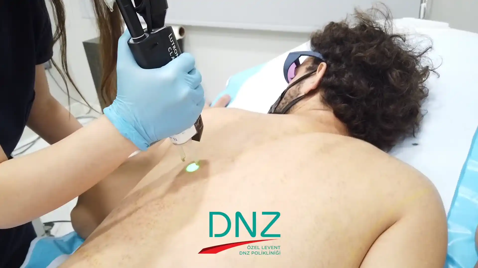 lazer-epilasyon-fiyatlari