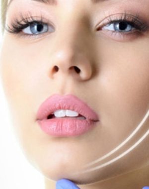 iple-yuz-germe-iplikle-askilama-5e1dd1062d8d8-b